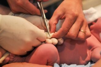 Umbilical Cord Care Tips for New Parents