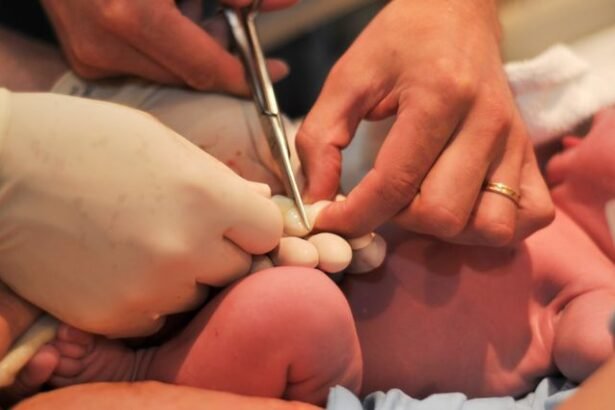 Umbilical Cord Care Tips for New Parents